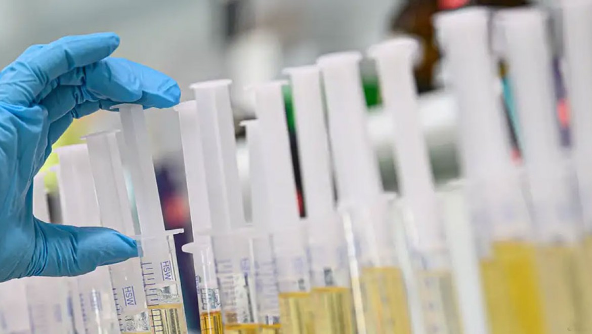 Sporda doping neden engellenemiyor?